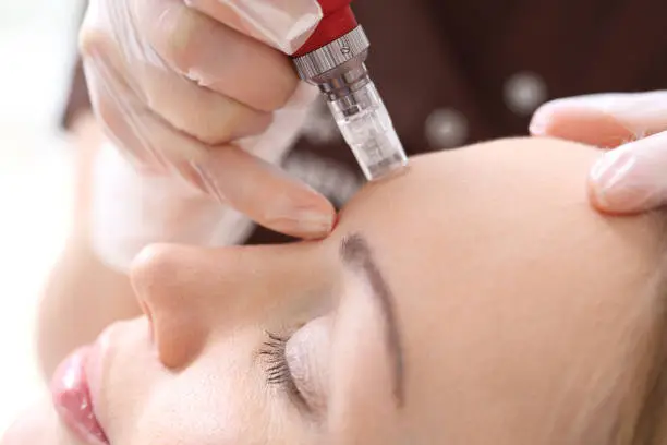 Mesotherapy microneedle, the woman at the beautician