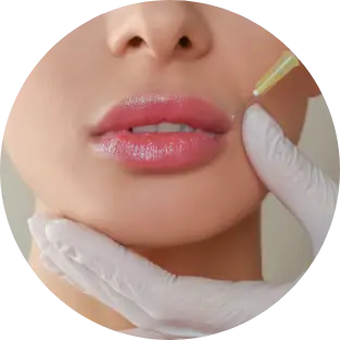 lipfiller-behandeling-in-terneuzen-omgeving